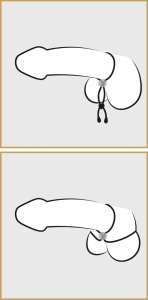 Лассо на пенис и мошонку Bad Kitty Cock & Ball Loop 514675ON