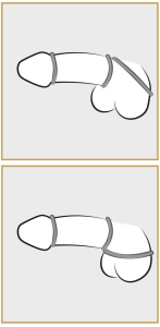 Набор силиконовых колец для пениса 537217ON